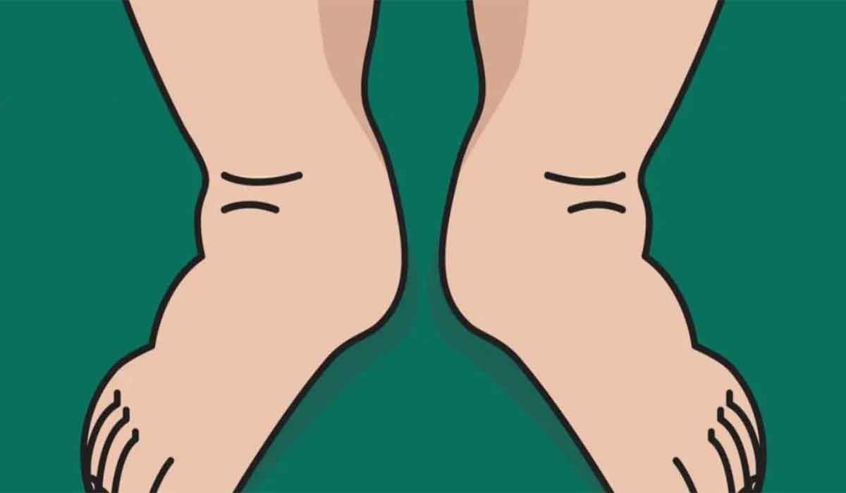 4 Moyens naturels pour soulager le gonflement des pieds et des chevilles