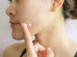 Traitement naturel pour éliminer les cicatrices d’acné